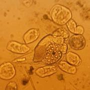 Dịch vụ phân tích và soi chiếu mẫu vật qua kính hiển vi